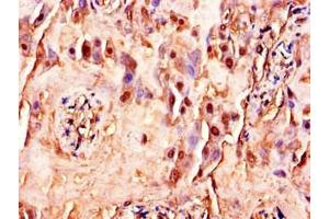 Immunohistochemistry of paraffin-embedded human placenta tissue using ABIN7175388 at dilution of 1:100 (FLT4 anticorps  (AA 1112-1329))