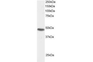 Image no. 1 for anti-Sorting Nexin 15 (SNX15) (C-Term) antibody (ABIN374315) (SNX15 anticorps  (C-Term))