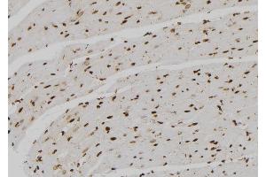 ABIN6273536 at 1/100 staining Rat heart tissue by IHC-P. (SNAPC4 anticorps  (N-Term))