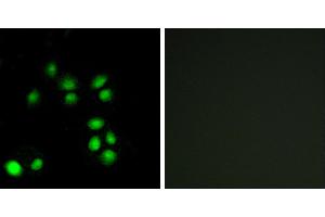 Peptide - +Western blot analysis of extracts from A549 cells, using EXO1 antibody.