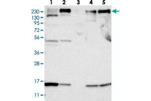 Western blot analysis of Lane 1: RT-4, Lane 2: U-251 MG, Lane 3: Human Plasma, Lane 4: Liver, Lane 5: Tonsil with ARAP2 polyclonal antibody  at 1:250-1:500 dilution. (ARAP2 anticorps)