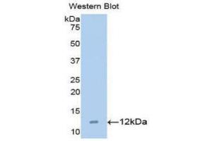 Western Blotting (WB) image for anti-Chemokine (C-C Motif) Ligand 15 (CCL15) (AA 22-113) antibody (ABIN1173091) (CCL15 anticorps  (AA 22-113))