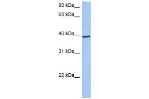 ACADM antibody used at 1 ug/ml to detect target protein. (Medium-Chain Specific Acyl-CoA Dehydrogenase, Mitochondrial (N-Term) anticorps)