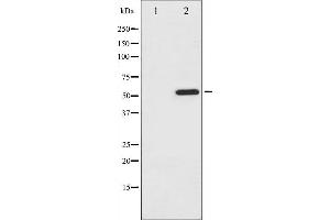 Western blot analysis of ATF2 phosphorylation expression in MDA-MB-435 whole cell lysates,The lane on the left is treated with the antigen-specific peptide.