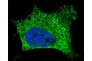 Fluorescent confocal image of SY5Y cells stained with NGFR antibody.