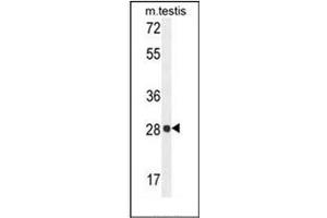 Western blot analysis of PGAM2 Antibody (N-term) in mouse testis tissue lysates (35ug/lane). (PGAM2 anticorps  (N-Term))