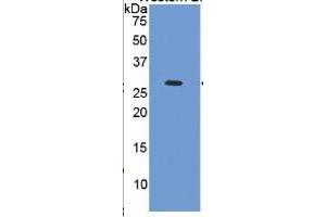 WB of Protein Standard: different control antibodies  against Highly purified E.