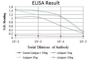 Red: Control Antigen (100 ng), Purple: Antigen (10 ng), Green: Antigen (50 ng), Blue: Antigen (100 ng),