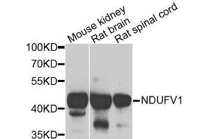 Western blot analysis of extracts of various cell lines, using NDUFV1 antibody. (NDUFV1 anticorps  (AA 1-250))