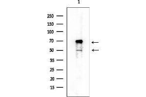 Western blot analysis of lysates from Rat spleen, using Semaphorin 3B Mouse Monoclonal Antibody at 1/1000 dilution.