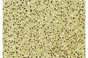 ABIN6277243 at 1/100 staining Mouse liver tissue by IHC-P. (PSMA1 anticorps  (C-Term))