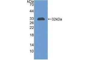Detection of Recombinant CR1, Human using Polyclonal Antibody to Complement Receptor 1, Erythrocyte (CR1) (CD35 anticorps  (AA 1780-2039))