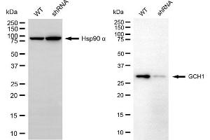 anti-GTP Cyclohydrolase 1 (GCH1) antibody