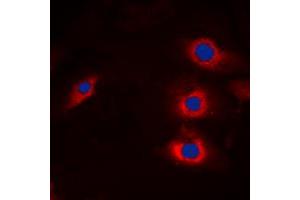 Immunofluorescent analysis of HECW2 staining in A549 cells.