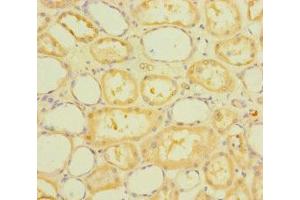 Immunohistochemistry of paraffin-embedded human kidney tissue using ABIN7168465 at dilution of 1:100 (RUFY4 anticorps  (AA 174-473))