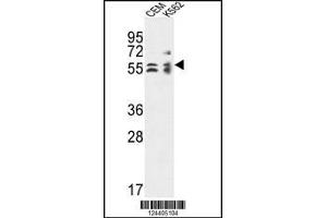 Western blot analysis in CEM,K562 cell line lysates (35ug/lane). (TBCE anticorps  (AA 364-392))