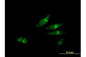 Immunofluorescence of purified MaxPab antibody to SCYL3 on HeLa cell.