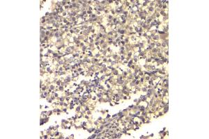 IHC analysis of ATP citrate lyase using anti-ATP citrate lyase antibody (ABIN6719406).