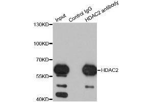 Immunoprecipitation analysis of 200ug extracts of K562 cells using 1ug HDAC2 antibody. (HDAC2 anticorps)