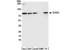Western Blotting (WB) image for anti-serine/threonine Kinase 33 (STK33) (AA 464-514) antibody (ABIN7449203)