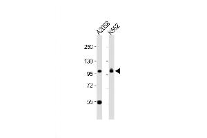 Western Blot at 1:1000 dilution Lane 1: A2058 whole cell lysate Lane 2: K562 whole cell lysate Lysates/proteins at 20 ug per lane. (COPG anticorps  (C-Term))