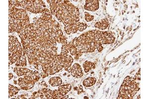 IHC-P Image Immunohistochemical analysis of paraffin-embedded Cal27 xenograft, using COX5A, antibody at 1:500 dilution.
