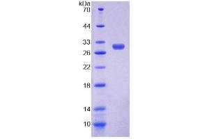 SDS-PAGE analysis of Rat MPP3 Protein.