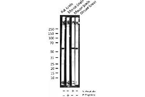 Western blot analysis of Phospho-Smad2 (Ser467) expression in various lysates