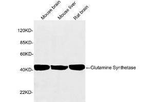 Western blot analysis of tissue lysates using 1 µg/mL Rabbit Anti-Glutamine Synthetase Polyclonal Antibody (ABIN398821) The signal was developed with IRDyeTM 800 Conjugated Goat Anti-Rabbit IgG.