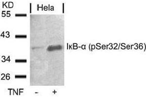 Image no. 3 for anti-Nuclear Factor of kappa Light Polypeptide Gene Enhancer in B-Cells Inhibitor, alpha (NFKBIA) (pSer32), (pSer36) antibody (ABIN196874) (NFKBIA anticorps  (pSer32, pSer36))