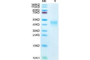 Biotinylated Human PD-1 on Tris-Bis PAGE under reduced .