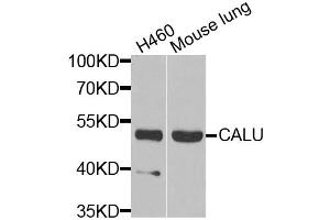 Western blot analysis of extracts of various cell lines, using CALU antibody (ABIN5973922) at 1/1000 dilution. (CALU anticorps)