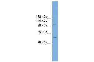 TNNI3K antibody used at 1 ug/ml to detect target protein. (TNNI3K anticorps  (N-Term))