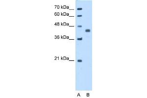 WB Suggested Anti-PDHA1 Antibody Titration:  5. (PDHA1 anticorps  (N-Term))