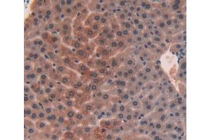 Used in DAB staining on fromalin fixed paraffin- embedded liver tissue