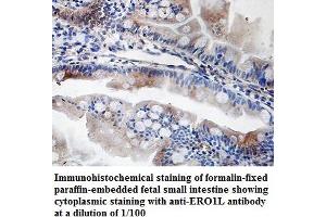 Image no. 1 for anti-ERO1-Like Protein alpha (ERO1L) antibody (ABIN1576363) (ERO1L anticorps)