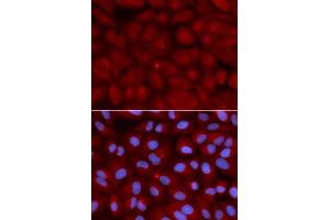 Immunofluorescence analysis of U2OS cell using BIN1 antibody.