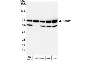Western Blotting (WB) image for anti-Coactivator-Associated Arginine Methyltransferase 1 (CARM1) (C-Term) antibody (ABIN7454627)