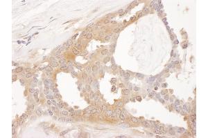Immunohistochemistry (IHC) image for anti-Chaperonin Containing TCP1, Subunit 8 (Theta) (CCT8) (AA 1-50) antibody (ABIN7453618) (CCT8 anticorps  (AA 1-50))