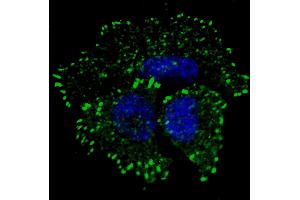 Fluorescent confocal image of MCF7 cells stained with phospho-ERBB2- antibody.