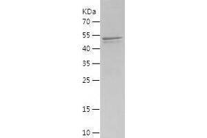 Western Blotting (WB) image for KIAA0226 (KIAA0226) (AA 10-278) protein (His-IF2DI Tag) (ABIN7123683)