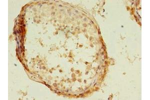 Immunohistochemistry of paraffin-embedded human testis tissue using ABIN7157249 at dilution of 1:100 (KBTBD4 anticorps  (AA 151-415))
