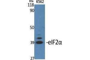 Western Blot (WB) analysis of specific cells using eIF2alpha Polyclonal Antibody. (EIF2A anticorps  (Ser326))