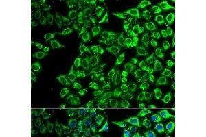 Immunofluorescence analysis of A549 cells using LIPC Polyclonal Antibody (LIPC anticorps)