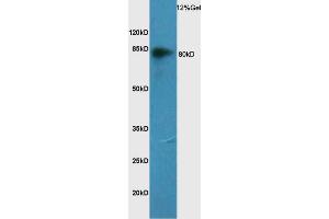 Rat lung lysate probed with Anti CD44 Polyclonal Antibody, Unconjugated (ABIN741270) at 1:200 overnight at 4 °C.