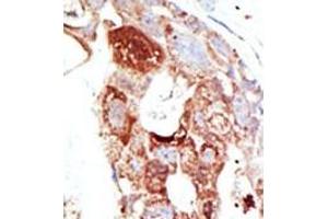 Image no. 2 for anti-SUMO1/sentrin Specific Protease 6 (SENP6) (C-Term) antibody (ABIN356759) (SENP6 anticorps  (C-Term))