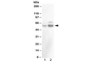 Western blot testing of 1) rat testis and 2) mouse testis with ALDH1A2 antibody at 0.