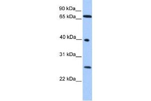 Western Blotting (WB) image for anti-Lethal(3) Malignant Brain Tumor-Like Protein 2 (L3MBTL2) antibody (ABIN2457889) (L3MBTL2 anticorps)