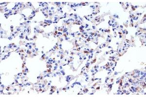 Immunohistochemistry of paraffin-embedded Rat lung using SFTPC Polyclonal Antibody at dilution of 1:200 (40x lens).