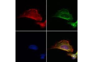 ABIN6264426 and ABIN6272879 staining Hela by IF/ICC.